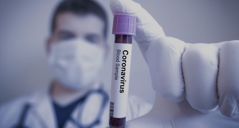 Planos de saúde ainda não cobrem gastos com teste do novo ...