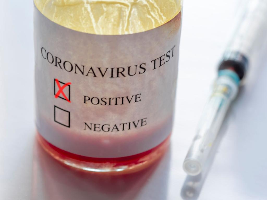 coronavírus coviv covid-19 teste exame positivo