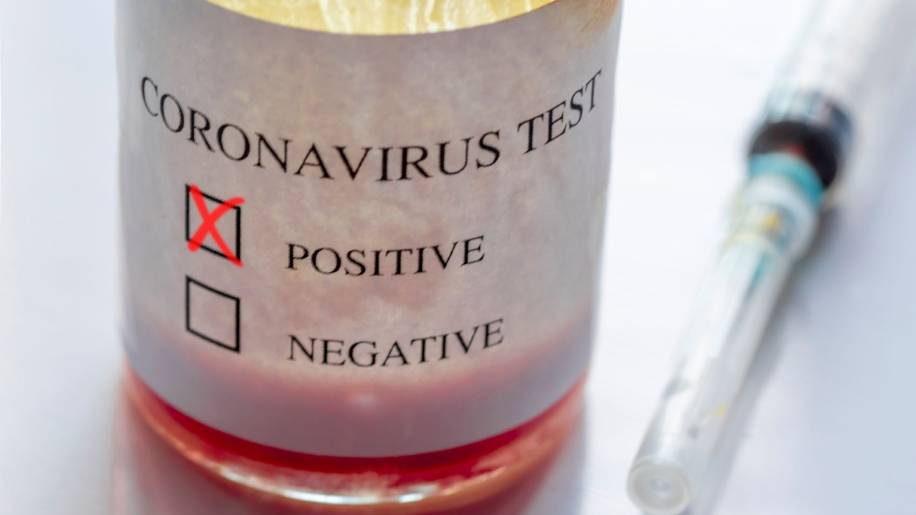 coronavírus coviv covid-19 teste exame positivo