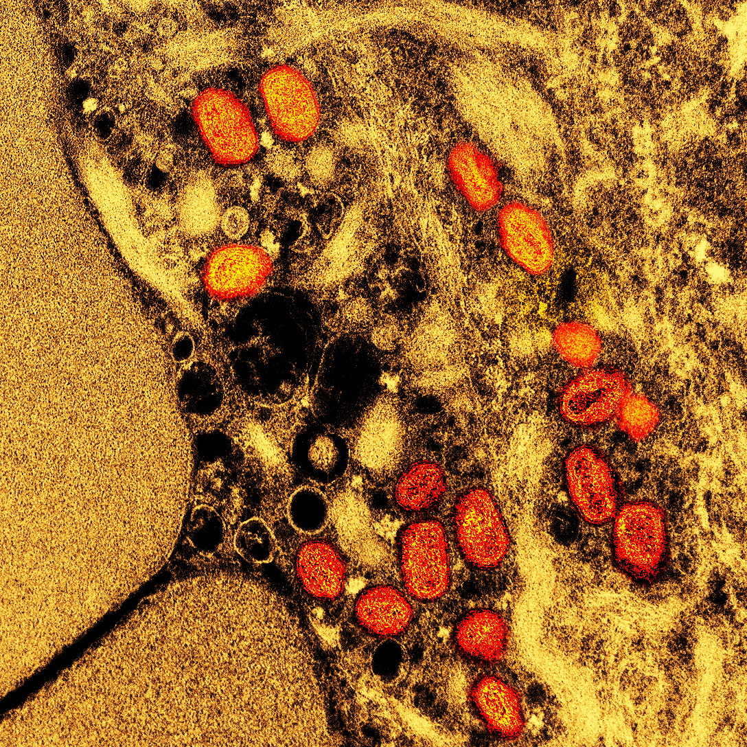 Micrografia eletrônica de transmissão colorida de partículas do vírus mpox capturadas no NIAID