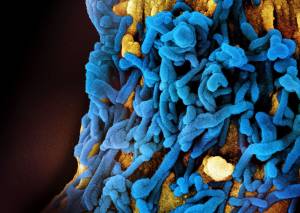 Etiópia confirma surto de vírus altamente letal da família do ebola Etiópia confirma surto de vírus altamente letal da família do ebola