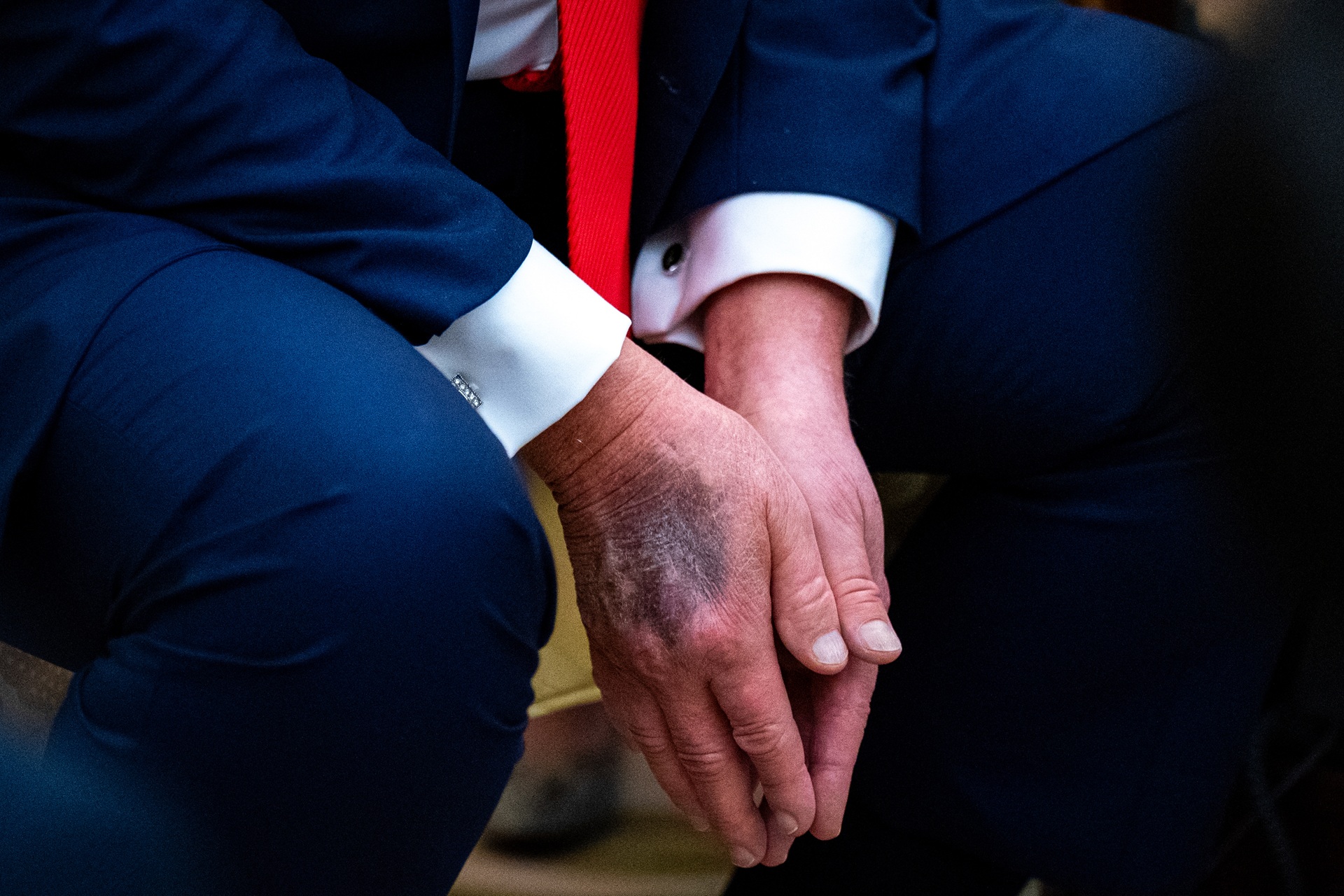 Nova ida de Trump ao médico reacende dúvidas sobre sua condição de saúde