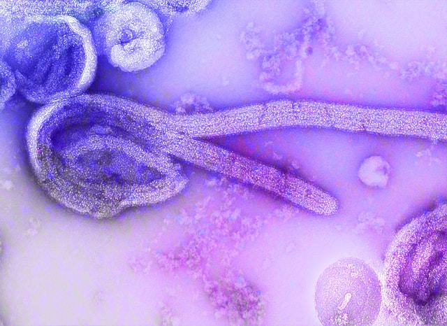 Paciente com suspeita de Ebola é isolado na Áustria; caso gera alerta na Europa