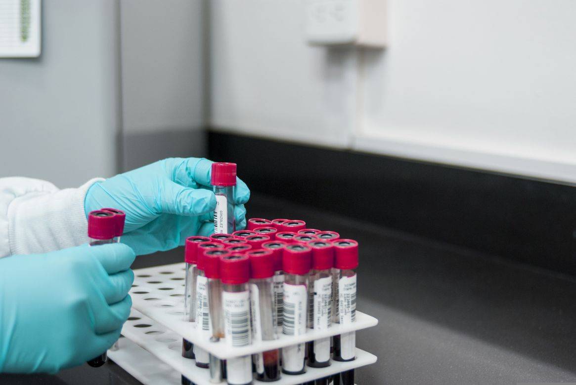Novo exame de sangue para detectar sinais de Alzheimer foi aprovado nos EUA; entenda